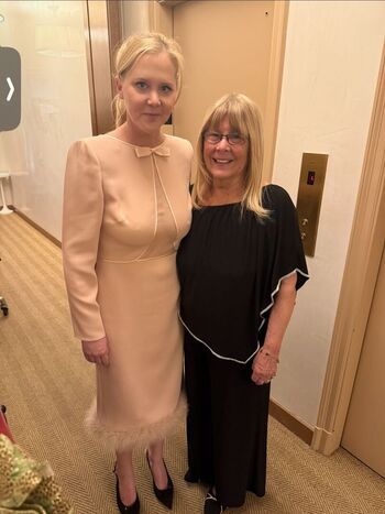 Amy schumer 1 image