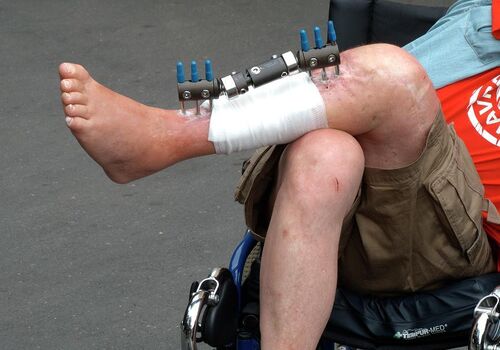 Brokenleg image