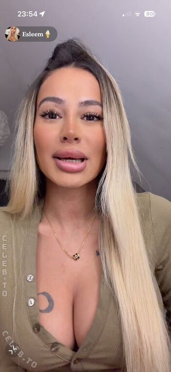 Esleem 20 image