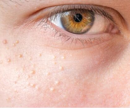 I m e m i l i a image