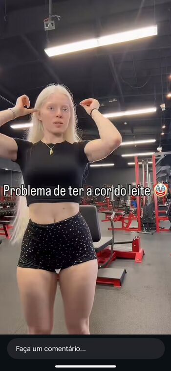 Melissa A Albina