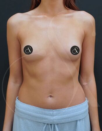 Miafemtech image