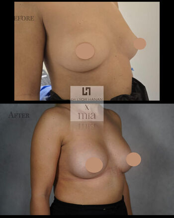 Miafemtech image