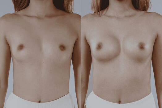 Miafemtech image