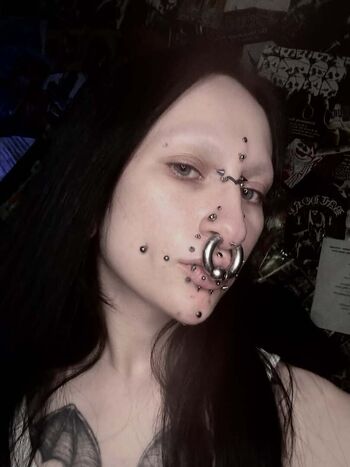 Mvtiilati0n image