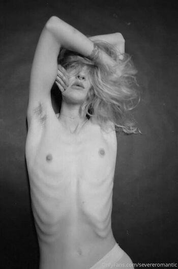 Severeromantic image