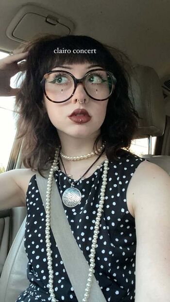 Smallwoundedfawn image