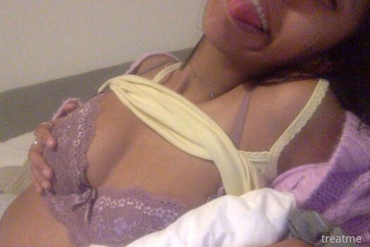 Treatme image