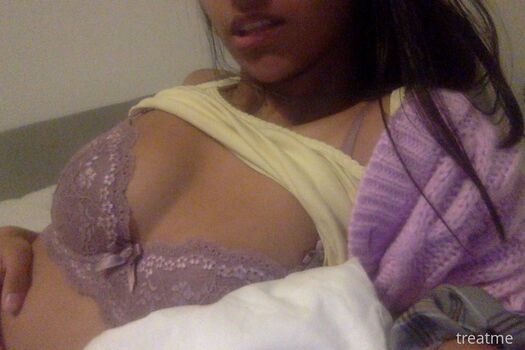 Treatme image