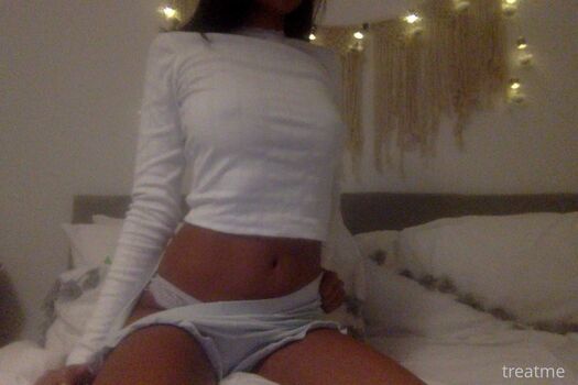 Treatme image