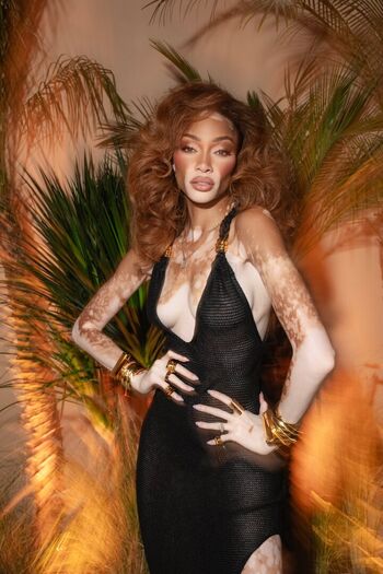 Winnie harlow page 2 image