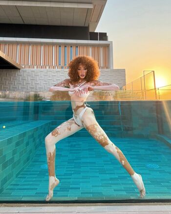 Winnie harlow page 2 image