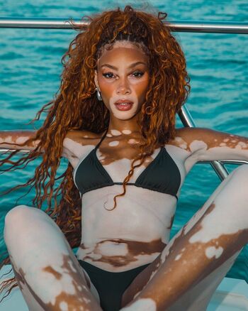 Winnie harlow page 2 image