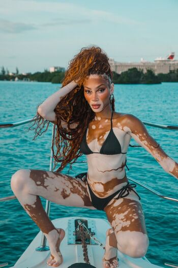 Winnie harlow page 2 image