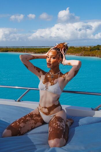 Winnie harlow page 2 image