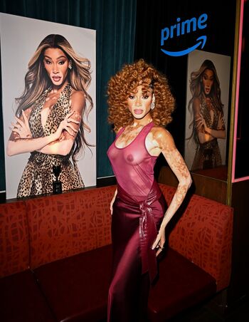 Winnie harlow page 2 image