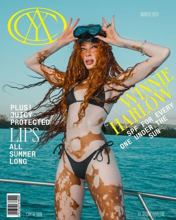Winnie harlow page 2 image