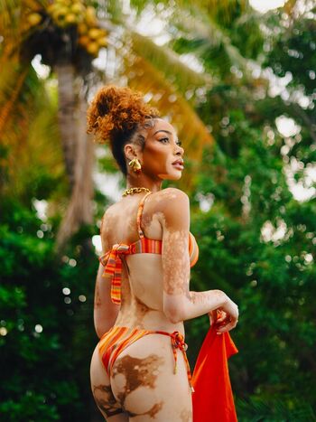 Winnie harlow page 2 image