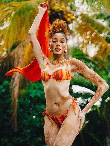 Winnie harlow page 2 image